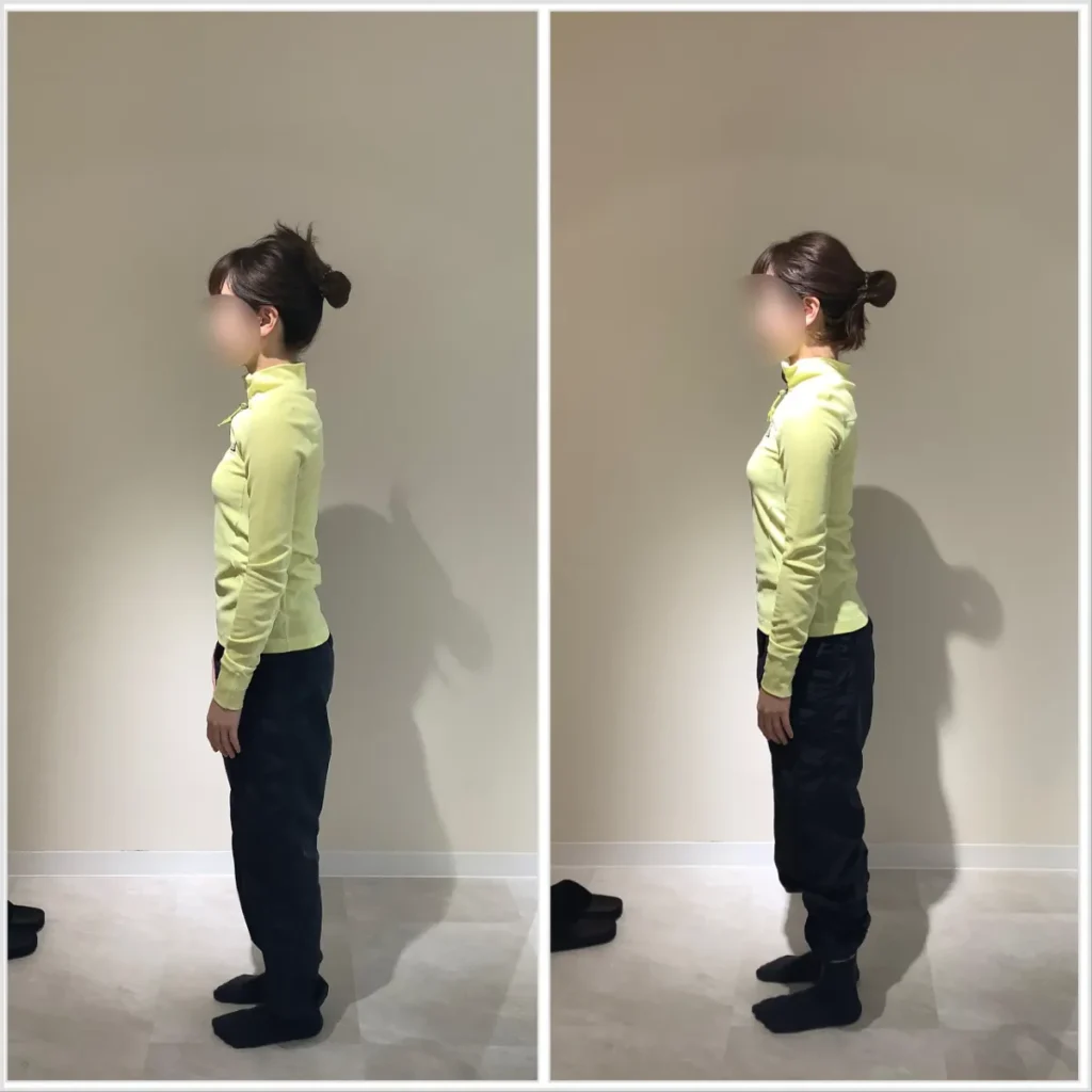 ピラティススタジオ『ルルト』札幌店before after